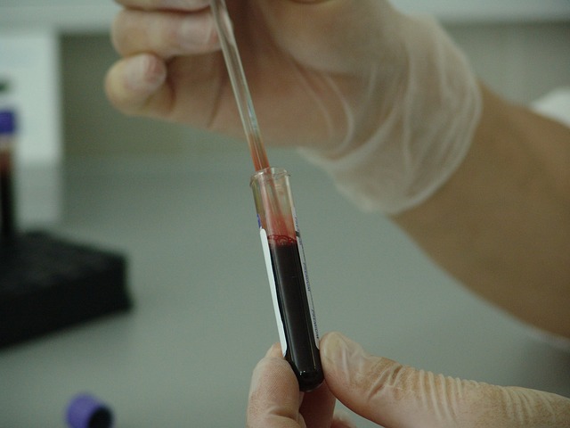 Blood & Urine Tests