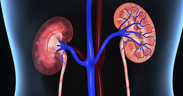 Chronic Kidney Disease and Kidney Failure 慢性肾病和肾衰竭