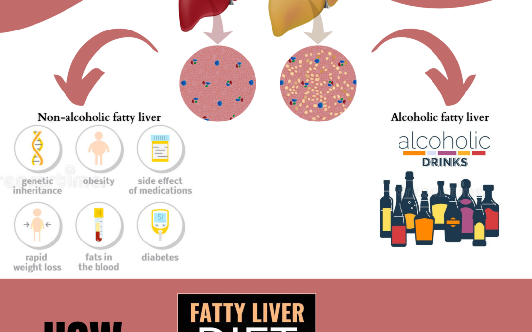 Fatty Liver  脂肪肝