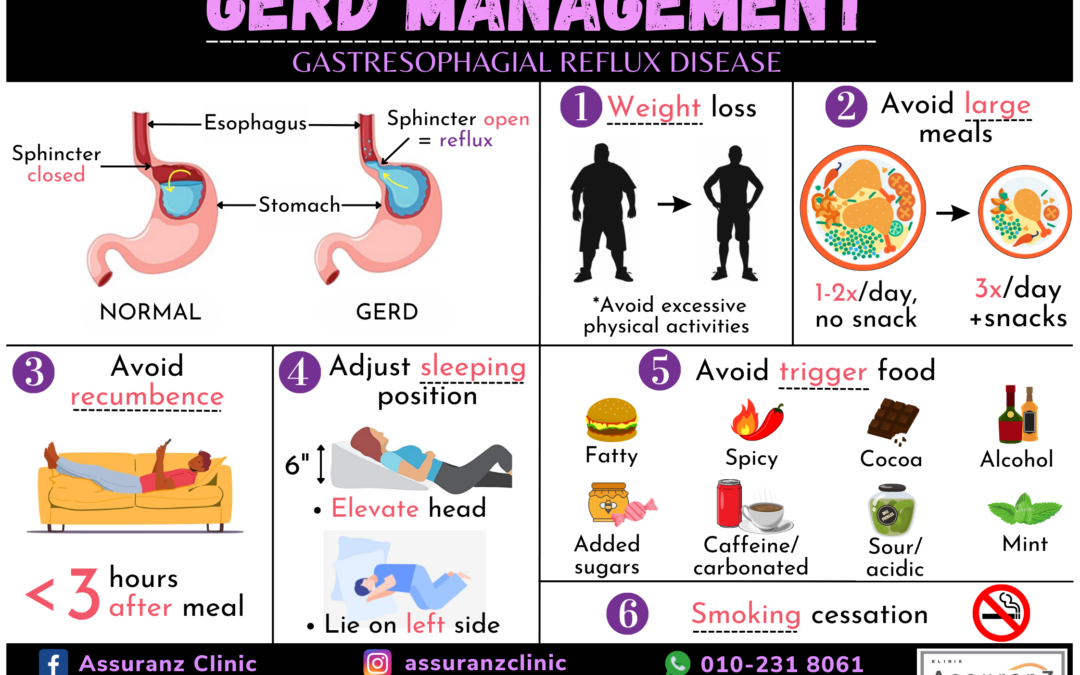 Gastroesophageal reflux diseases (GERD) 胃酸倒流或胃食道反流症（GERD）