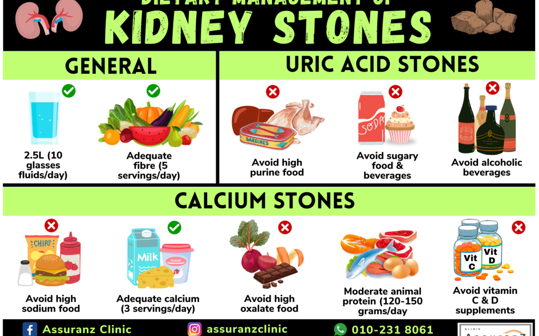 Kidney Stones: Dietary Management 肾结石：饮食管理