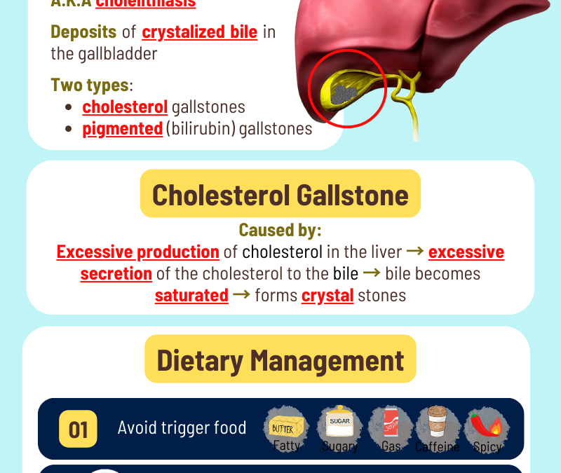 Diet for Gallbladder Stone 胆结石饮食指南